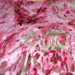 SF-1035 - Ντεβορέ Εμπριμέ